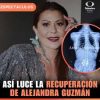 Alejandra Guzman aparece en redes mostrando una radiografia de su cirugia
